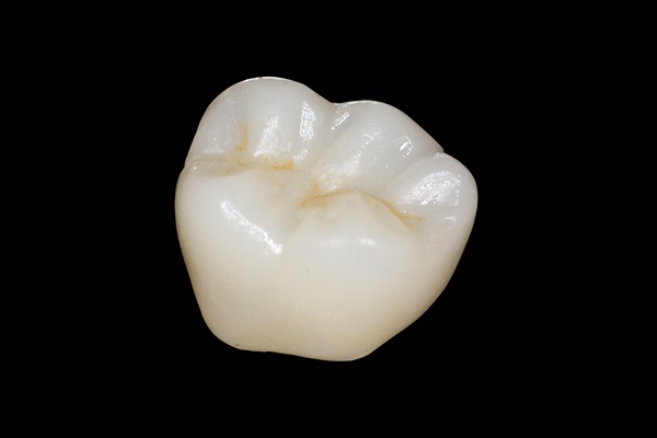 Popularity And Availability Of CEREC Crowns