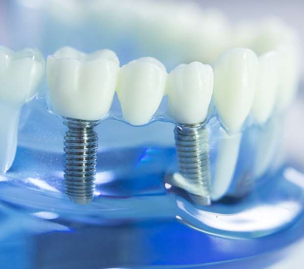 Grayslake Dental Implants