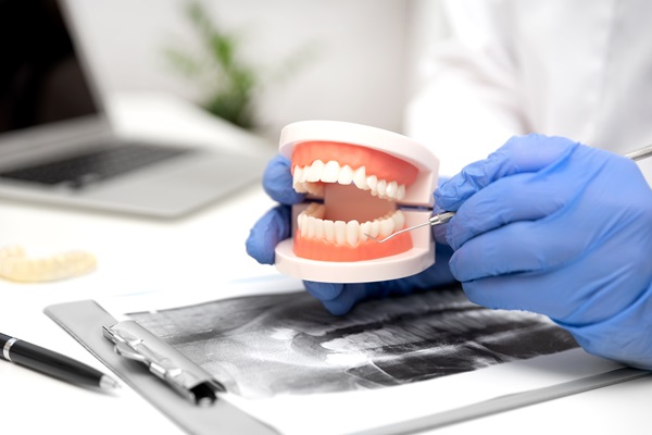 Repair Options For Partial Dentures