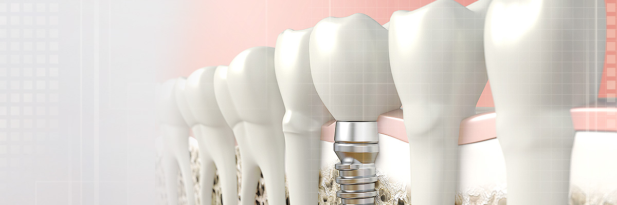 Grayslake Implant Dentist