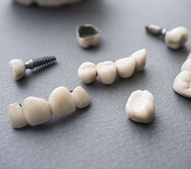 Grayslake The Difference Between Dental Implants and Mini Dental Implants