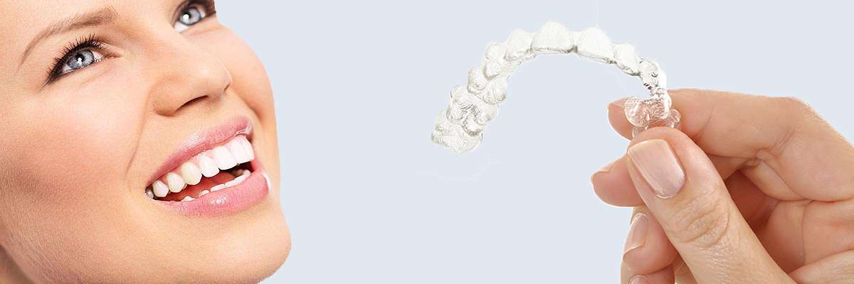 Grayslake 7 Things Parents Need to Know About Invisalign Teen