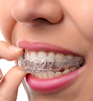 Clear Aligners - Almost Invisible Braces Grayslake, IL