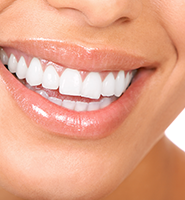 Teeth Whitening Services Grayslake, IL