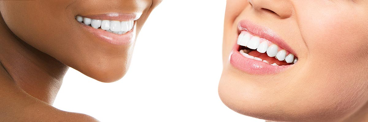 Grayslake Teeth Whitening