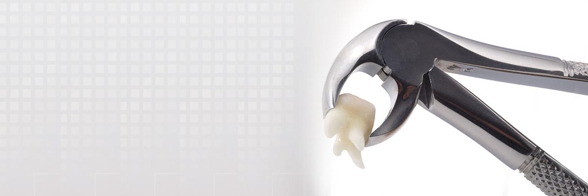 Grayslake Tooth Extraction